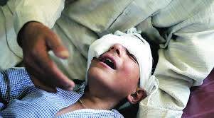 مقبوضہ کشمیر میں چار ماہ کے دوران 6205شہریوں کو پیلٹ گن کا نشانہ بنے
