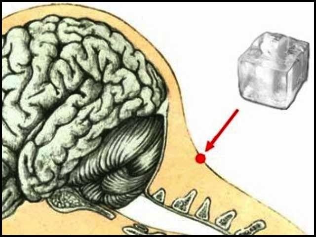 برف سے علاج کا قدیم اورحیرت انگیز طریقہ