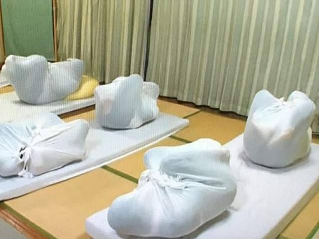  مریض کو گٹھڑی میں بند کرکے جوڑوں کے درد سے نجات کا عجیب طریقہ
