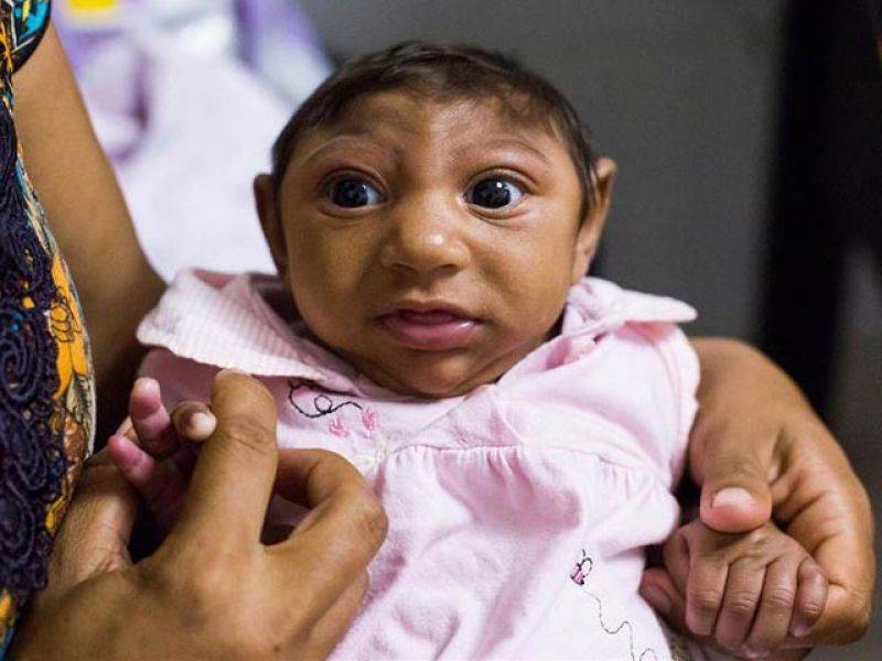 وہ علاقہ جہاں سینکڑوں بچوں کی شکلیں ایسی ہو گئیں ، وجہ انتہائی حیران کن!