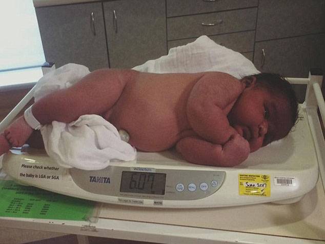 میلبرن میں دنیا کے وزنی ترین بچے کی پیدائش