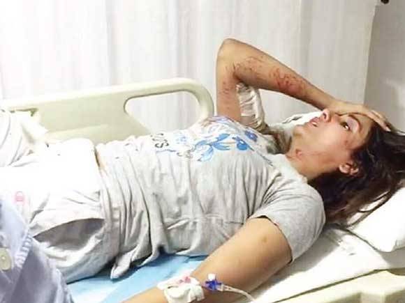  معروف اداکارہ پارل یادیو کو آوارہ کتوں نے بھنبھوڑ دیا جس کے نتیجے میں شدید زخمی ہوگئیں