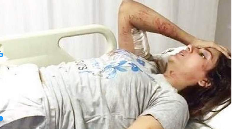 آوارہ کتوں کے جان لیوا حملے میں زخمی ہونے والی معروف بھارتی اداکارہ کی حالت بدستور تشویشناک 
