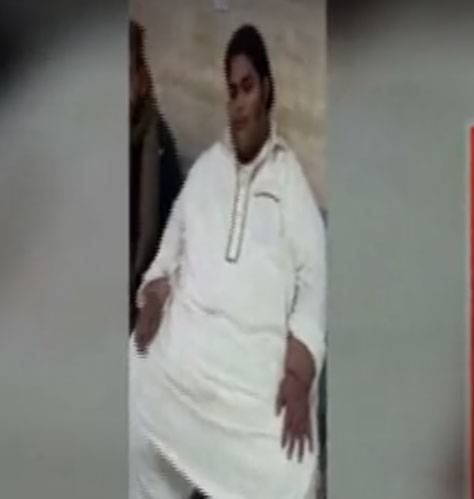  لاہور: ڈاکٹروں نے تین سو کلو وزنی جاوید کے معدے کا سائز چھوٹا کر دیا