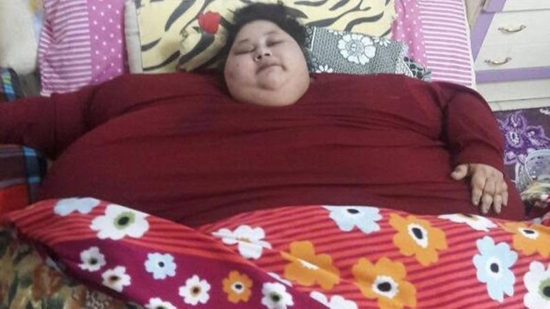 دنیا کی سب سے وزنی لڑکی علاج کےلئے بھارت منتقل 
