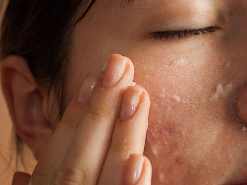 چہرے کی جلد کو خوبصورت ، جوان اور پرکشش بنانے کا سب سے آسان طریقہ سامنے آگیا