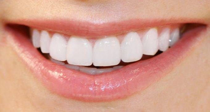 صاف اور صحت مند دانتوں کیلئے سادہ احتیاطی تدابیروں پر عمل کریں