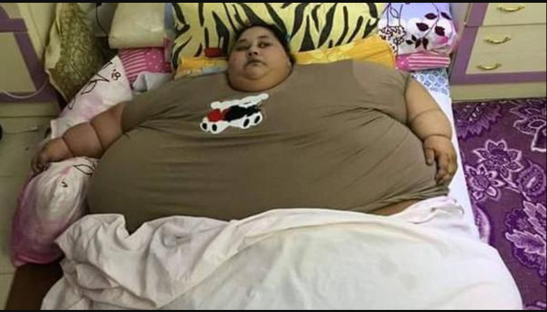 ممبئی : مصری لڑکی کے وزن میں نمایاں کمی ، ڈاکٹروں نےجسم سے 75فیصد چربی ختم کر دی 