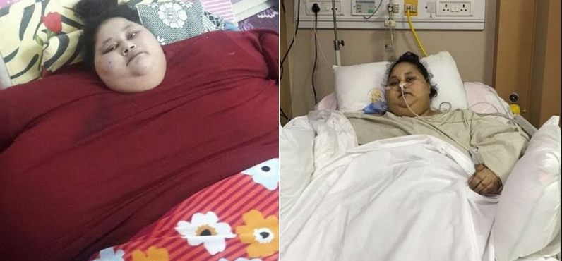موٹاپے کا شکار مصری لڑکی کاکامیاب علاج،بھارتی ڈاکٹروں کا دعویٰ جھوٹ نکلا