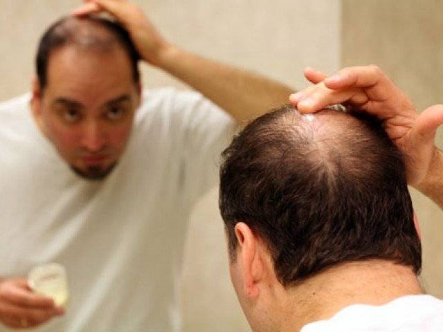 گنج پن روکنے کیلئے ماہرین نے حیرت انگیز دعویٰ کر دیا 