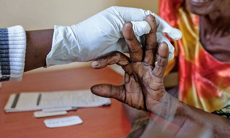 ملیریا سے چھٹکارہ حاصل کرنے کیلئے انتہائی موثر دوا تیار 