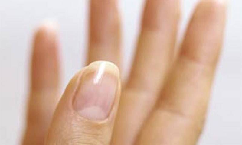 ناخنوں پر چاندکا نشان ہونا متعدد بیماریوں کی علامت ہے ،ماہرین 