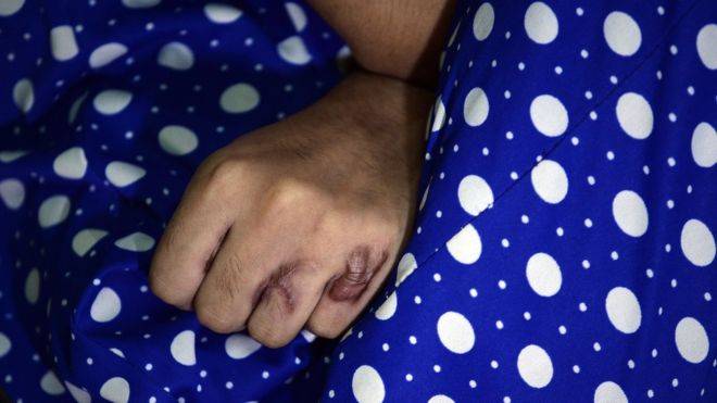 بھارت میں ریپ کے بعد خاتون پر پانچویں مرتبہ تیزاب سے حملہ