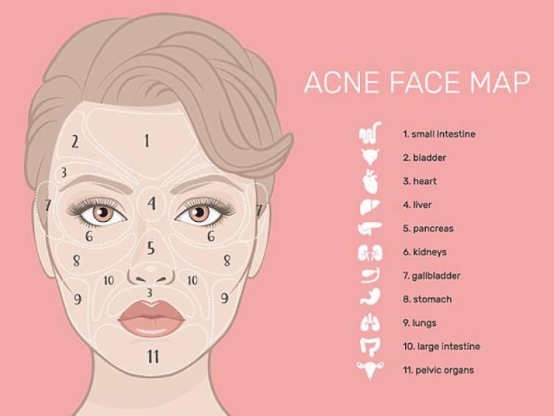 چہرے پر نکلنے والے دانوں کا راز کھل گیا