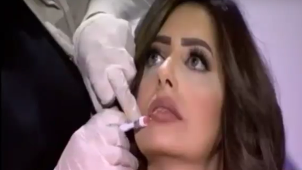 مصری ٹی وی خاتون میزبان کے ہونٹوں کی براہ راست نشریات سرجری