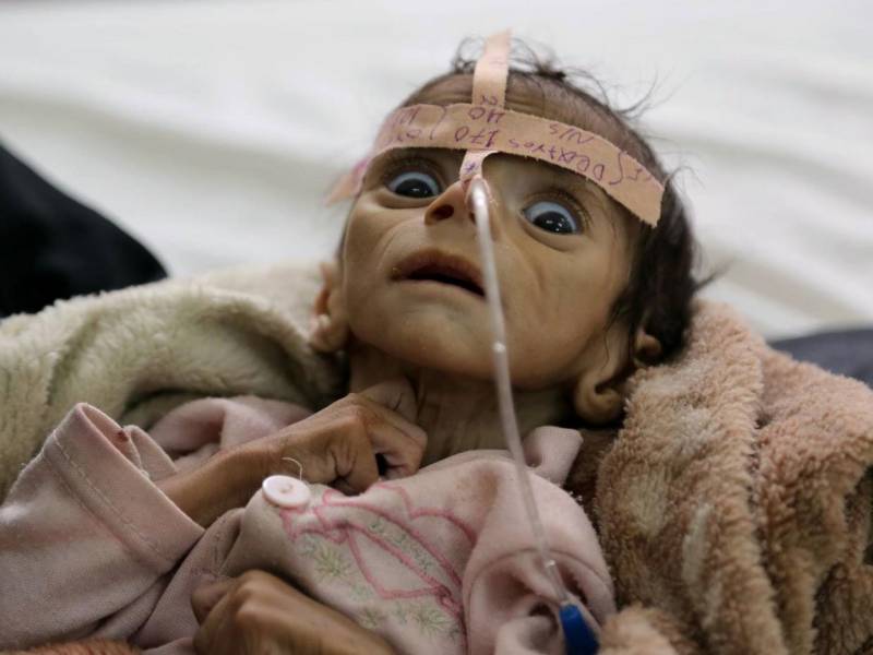 سعودی حملوں میں اب تک یمن میں 3ہزار بچے شہید ہو چکے ہیں