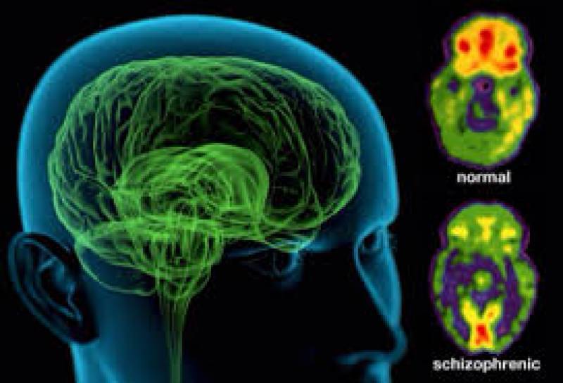 سائنسدانوں نے ذہنی بیماری شیزو فرینیا کے علاج میں نمایاں کامیابی حاصل کر لی