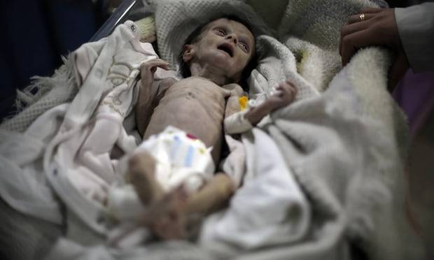ایک ماہ کی شامی بچی جو خوراک نہ ملنے کی وجہ سے انتقال کر گئی