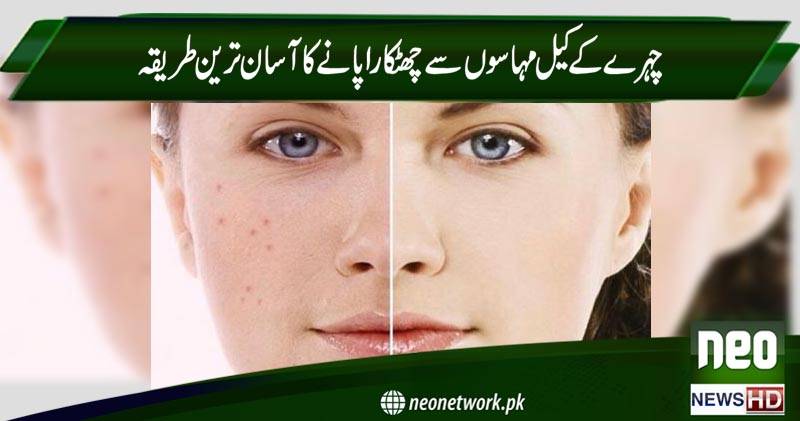 چہرے کے کیل مہاسوں سے چھٹکارا پانے کا آسان ترین طریقہ 