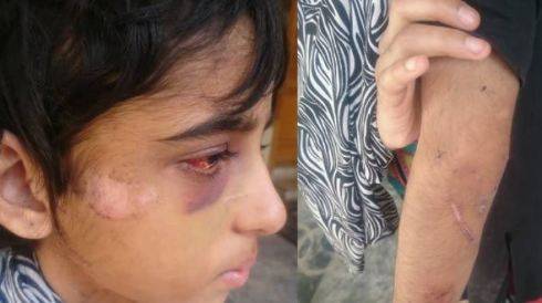 11 سالہ گھریلو ملازمہ پر تشدد، وفاقی وزیر برائے انسانی حقوق نے نوٹس لے لیا