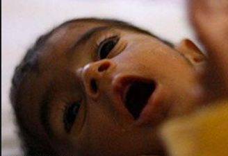 حکومت کاغذائی کمی کے شکار بچوں کیلئے خصوصی پروگرام شروع کرنے کا فیصلہ