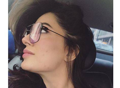 مہوش حیات جلدی مسائل کا شکار 