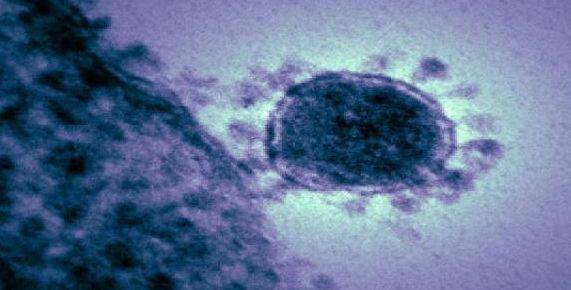 آسٹریلوی سائنسدانوں کا کرونا وائرس تخلیق کرنے کا دعویٰ