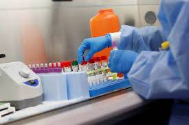 نسٹ یونیورسٹی نے کورونا وائرس کی ٹیسٹنگ کٹ تیار کر لی، فواد چوہدری