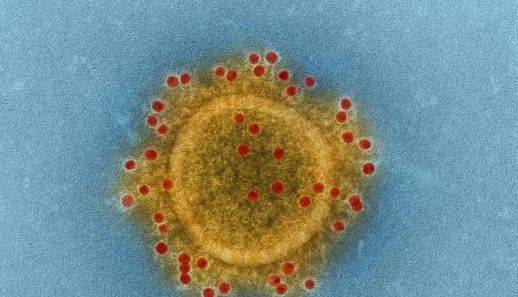پاکستان دنیابھر میں کورونا وائرس سے متاثرہ ممالک کی فہرست میں 26ویں نمبر پرآگیا 