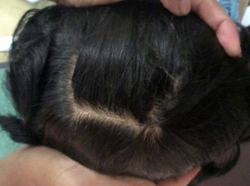 hair patch,men hair,lowest cost hair patch