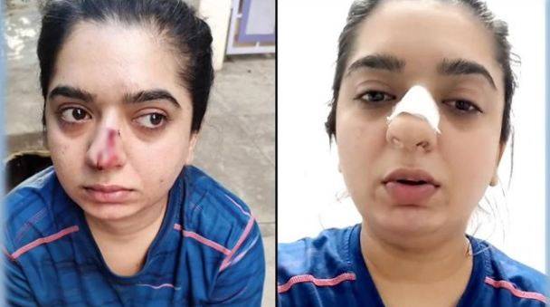 بھارتی ماڈل پر ڈلیوری بوائے کے تشدد کی اصل کہانی سامنے آگئی 