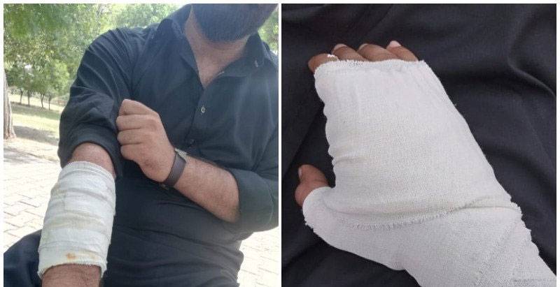 اسلامی جعمیت طلبا کا کالج کے طالب علم پر تشدد
