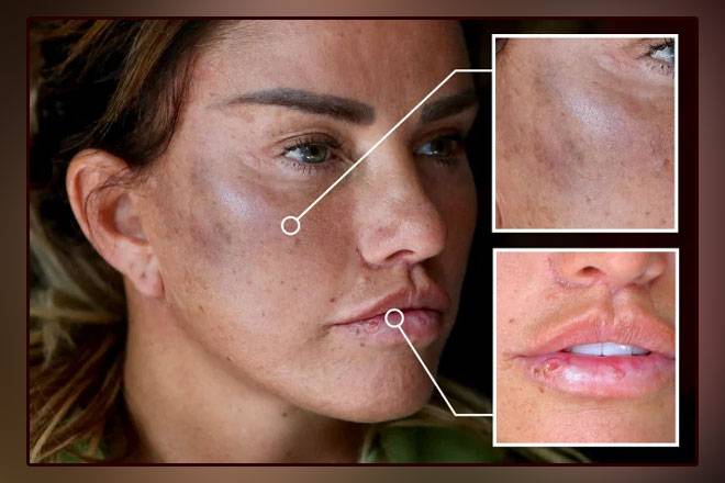 British actress Katie Price tortured by unknown assailant, hospitalized
