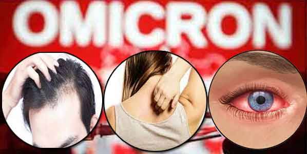 اومیکرون کی تین اہم علامات کونسی ہیں؟ ماہرین نے بتا دیا