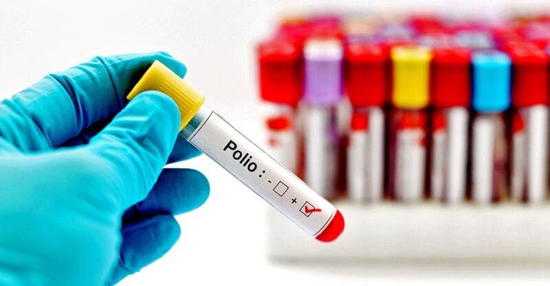 ملک کے متعدد اضلاع کے ماحولیاتی نمونوں میں پولیو وائرس کی تصدیق