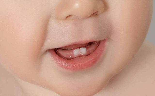 بچوں کے دودھ کے دانت سنبھالنا کیوں ضروری؟ 
