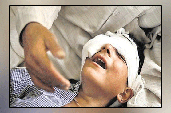 UN calls for immediate ban on pellet guns against children in Occupied Kashmir